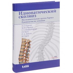 Идиопатический сколиоз. Руководство по лечению