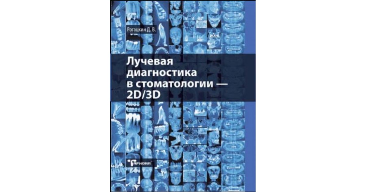 Д диагностика. Лучевая диагностика в стоматологии Рогацкин. Рогацкий рентгенология в стоматологии. Рентгенология в стоматологии книги. Рогацкин - лучевая диагностика в стоматологии - 2d/3d.