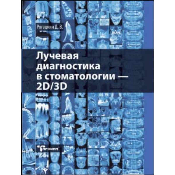 Лучевая диагностика в стоматологии. 2D/3D. Дмитрий Рогацкин