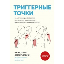 Триггерные точки
