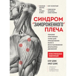 Синдром «замороженного» плеча