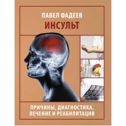 Инсульт. Причины, диагностика, лечение и реабилитация