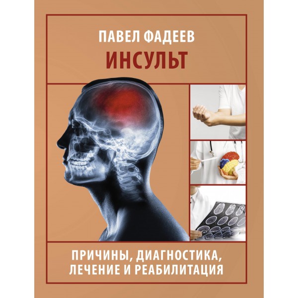 Инсульт. Причины, диагностика, лечение и реабилитация. Павел Фадеев